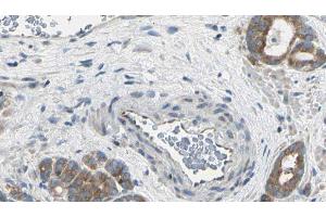 ABIN6275049 at 1/100 staining Human prostate tissue by IHC-P. (AGBL2 Antikörper  (C-Term))