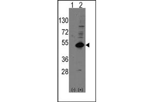 Image no. 1 for anti-Nuclear Receptor Subfamily 0, Group B, Member 1 (NR0B1) (C-Term) antibody (ABIN357834) (NR0B1 Antikörper  (C-Term))