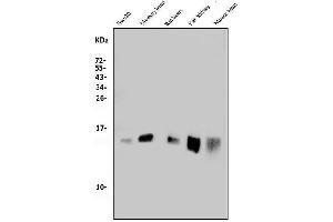 Western blot analysis of MitoNEET/CISD1 using anti-MitoNEET/CISD1 antibody (ABIN7601089).