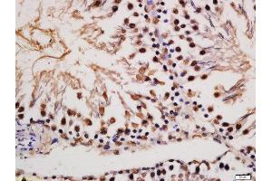 Formalin-fixed and paraffin embedded rat testis labeled with Rabbit Anti-MAP2(Ser136) Polyclonal Antibody, Unconjugated (ABIN743648) at 1:200 followed by conjugation to the secondary antibody and DAB staining (MAP2 Antikörper  (pSer136))