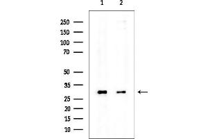 anti-Dynein, Axonemal, Light Intermediate Chain 1 (DNALI1) antibody