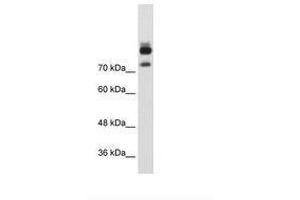 Image no. 1 for anti-Myotubularin Related Protein 1 (MTMR1) (AA 551-600) antibody (ABIN203423)