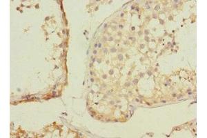 Immunohistochemistry of paraffin-embedded human testis tissue using ABIN7176401 at dilution of 1:100 (ZNF582 Antikörper  (AA 1-300))