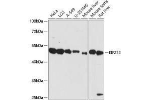 Western blot analysis of extracts of various cell lines, using EIF2S2 antibody (ABIN7267033) at 1:3000 dilution. (EIF2S2 Antikörper  (AA 1-175))