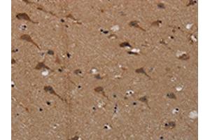 The image on the left is immunohistochemistry of paraffin-embedded Human brain tissue using ABIN7191822(PDE5A Antibody) at dilution 1/50, on the right is treated with synthetic peptide. (PDE5A Antikörper)