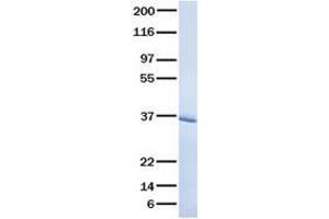 Validation with Western Blot