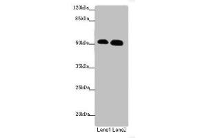 Western blot All lanes: ATMIN antibody at 1. (ATM Interactor Antikörper  (AA 160-360))