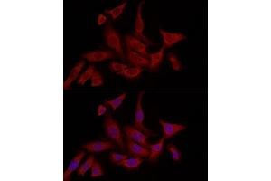 Immunofluorescence (IF) image for anti-Fatty Acid Binding Protein 5 (Psoriasis-Associated) (FABP5) (AA 1-135) antibody (ABIN6140422)