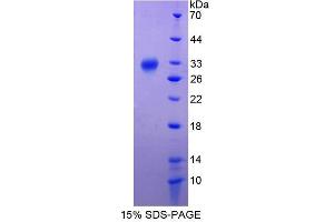 Image no. 1 for Apolipoprotein A-I Binding Protein (APOA1BP) (AA 33-288) protein (His tag) (ABIN4989987)