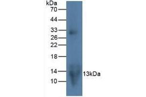 Detection of MIP3a in Rat Lymphocyte Cells using Monoclonal Antibody to Macrophage Inflammatory Protein 3 Alpha (MIP3a) (CCL20 Antikörper  (AA 24-95))