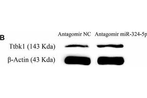 miRNA-324-5p acts onto Ttbk1 and downregulates Tau-tubulin kinase-1. (beta Actin Antikörper)