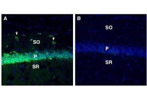 Expression of SORL1 in mouse hippocampus. (SORL1 Antikörper  (Extracellular, N-Term))