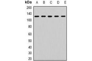 Western blot analysis of CD133 expression in K562 (A), SW620 (B), Jurkat (C), mouse kidney (D), mouse lung (E) whole cell lysates. (CD133 Antikörper  (N-Term))