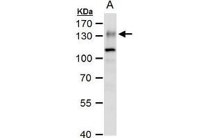WB Image ENPP1 antibody [N2C2], Internal detects ENPP1 protein by western blot analysis. (ENPP1 Antikörper)