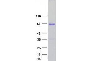 Validation with Western Blot (HMGXB4 Protein (Transcript Variant 1) (Myc-DYKDDDDK Tag))