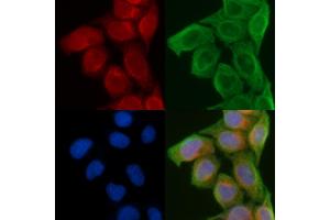 ABIN6258681 and ABIN6274241 staining Hela cells(45 min of heat-shock) by IF/ICC. (ACTN2/3 Antikörper  (N-Term))