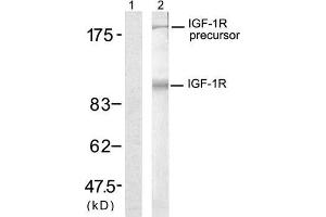 Western blot analysis of extract from 293 cells, using IGF-1R (Ab-1280) antibody (E021302, Lane 1 and 2). (IGF1R Antikörper)