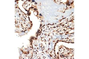 Immunohistochemistry of paraffin-embedded human placenta using CIRBP Rabbit mAb (ABIN7266452) at dilution of 1:100 (40x lens). (CIRBP Antikörper)