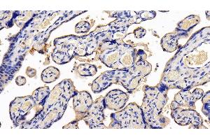 Detection of LIFR in Human Placenta Tissue using Polyclonal Antibody to Leukemia Inhibitory Factor Receptor (LIFR) (LIFR Antikörper  (AA 692-833))