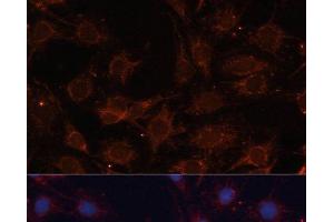 Immunofluorescence analysis of C6 cells using SLC25A24 Polyclonal Antibody at dilution of 1:100. (SLC25A24 Antikörper)