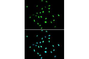 Immunofluorescence analysis of A549 cells using HDAC1 antibody. (HDAC1 Antikörper  (AA 393-482))
