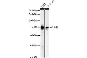 Western blot analysis of extracts of various cell lines, using SR-BI antibody (ABIN3022185, ABIN3022186, ABIN1513498 and ABIN6218655) at 1:1000 dilution. (SCARB1 Antikörper  (AA 1-100))