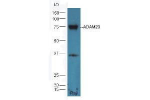 Raji lysate probed with Rabbit Anti-ADAM23 Polyclonal Antibody (ABIN758846) at 1:300 overnight in 4 °C.