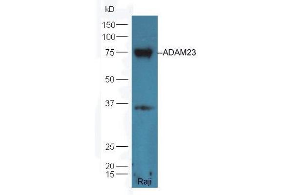 Adam23 Antikörper  (AA 551-650)
