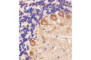 Immunohistochemistry (Paraffin-embedded Sections) (IHC (p)) image for anti-Palmitoyl-Protein Thioesterase 1 (PPT1) (AA 1-306) antibody (ABIN1944801)