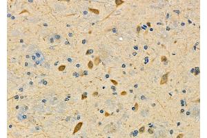 ABIN6262593 and ABIN6278013 at 1/100 staining Rat brain tissue by IHC-P.