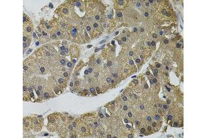 Immunohistochemistry of paraffin-embedded Human stomach using IL33 Polyclonal Antibody (IL-33 Antikörper)