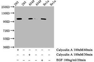 Western Blot  Positive WB detected in: 293 whole cell lysate, A549 whole cell lysate, Hela whole cell lysate (treated with Calyculin A or EGF)  All lanes: Phospho-ERN1 antibody at 0. (Rekombinanter ERN1 Antikörper  (pSer724))