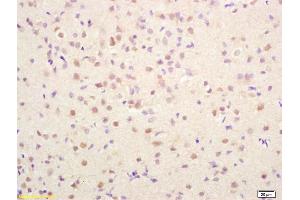 Formalin-fixed and paraffin embedded rat brain labeled with Rabbit Anti PRKAG2/AMPK? (AMPK gamma 1/2/3 (AA 280-330) Antikörper)