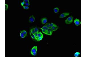 Immunofluorescent analysis of MCF-7 cells using ABIN7173183 at dilution of 1:100 and Alexa Fluor 488-congugated AffiniPure Goat Anti-Rabbit IgG(H+L) (TMEM256 Antikörper  (AA 30-63))