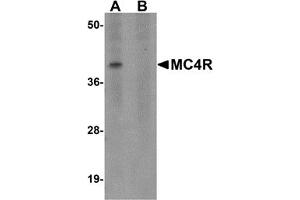 Western Blotting (WB) image for anti-Melanocortin 4 Receptor (MC4R) (N-Term) antibody (ABIN1031454)