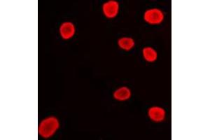 Immunofluorescent analysis of Histone Deacetylase 9 staining in Ramos cells. (HDAC9 Antikörper  (C-Term))