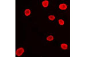 Immunofluorescent analysis of Histone Deacetylase 9 staining in Ramos cells.