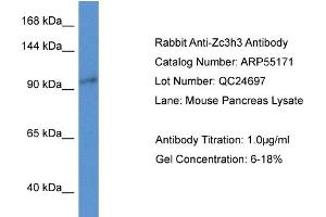 Western Blotting (WB) image for anti-Zinc Finger CCCH-Type Containing 3 (ZC3H3) (N-Term) antibody (ABIN2786081) (ZC3H3 Antikörper  (N-Term))