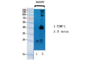 Western Blotting (WB) image for anti-TIMP Metallopeptidase Inhibitor 1 (TIMP1) (Internal Region) antibody (ABIN3187268) (TIMP1 Antikörper  (Internal Region))