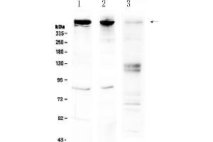 Western blot analysis of Sacsin using anti-Sacsin antibody . (Sacsin Antikörper  (AA 3709-3909))