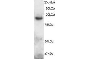 ABIN184726 staining (2µg/ml) of Human Brain lysate (RIPA buffer, 30µg total protein per lane). (ADAM8 Antikörper  (C-Term))