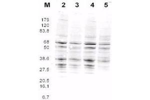 This product was assayed by western blotting against RFA2 containing cell lysates. (RPA2 Antikörper  (AA 115-129))