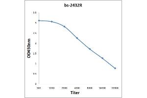 Antigen: 0. (ATG7 Antikörper  (AA 21-120))