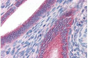 Human Uterus (formalin-fixed, paraffin-embedded) stained with DRAM antibody ABIN351448 at 3 ug/ml followed by biotinylated goat anti-rabbit IgG secondary antibody ABIN481713, alkaline phosphatase-streptavidin and chromogen. (DRAM Antikörper  (C-Term))