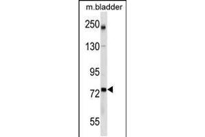 Western blot analysis in mouse bladder tissue lysates (35ug/lane). (GCLC Antikörper  (AA 286-315))