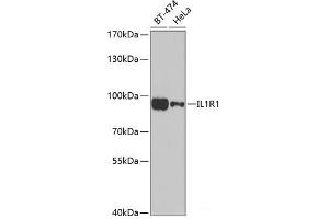 Western blot analysis of extracts of various cell lines using IL1R1 Polyclonal Antibody at dilution of 1:1000. (IL1R1 Antikörper)