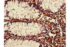 Immunohistochemistry (IHC) image for anti-ATG3 Autophagy Related 3 (ATG3) (AA 1-314) antibody (ABIN7174567)