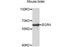 Western blot analysis of extracts of mouse brain, using EGR4 antibody (ABIN3049538). (EGR4 Antikörper)