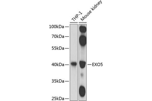 EXO5 anticorps  (AA 1-373)