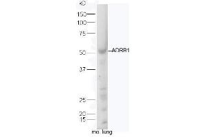 ADRB1 Antikörper  (AA 181-250)